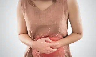 doenças inflamatórias digestivas, doenças do trato gastrointestinal;
